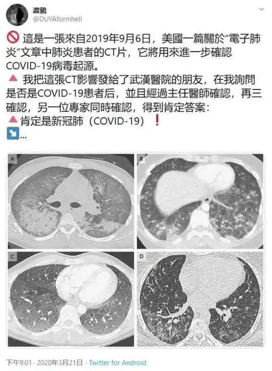 新冠肺炎起源、发现与初期反应，早期疫情状况分析